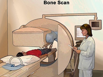 Bone Scan